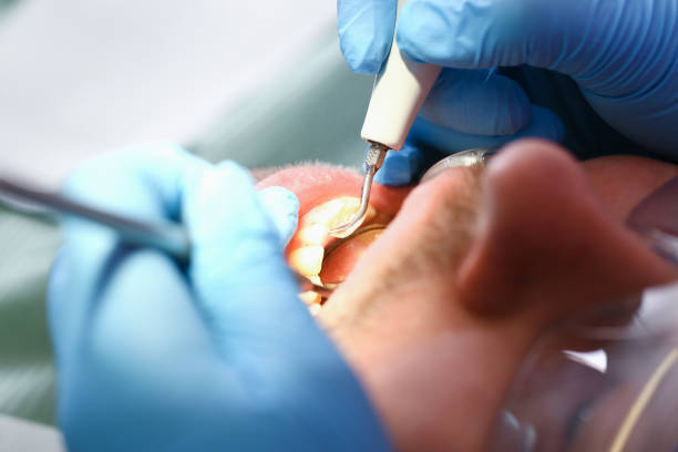 Best Orthodontic Emergency Dentist in Georgetown, SC