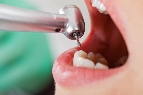 Best Mobile Emergency Dentist in Georgetown, SC